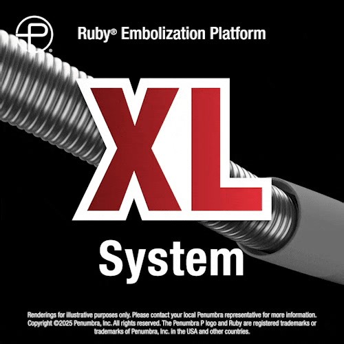 US HCPs: The latest addition to the Ruby Coil family is here. Learn more about the Ruby XL System and how it’s designed to support large vessel embolization procedures: https://peninc.info/456DC0d #RubyXL #MedDevice #Embolization #SomethingBIGisHERE Rx only. Risk: peninc.info/risk Clinical results may vary | Penumbra, Inc.