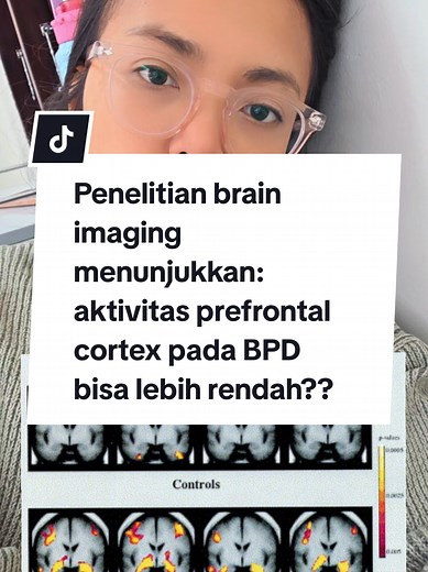 Aktivitas Prefrontal Cortex dan BPD: Memahami Emosi