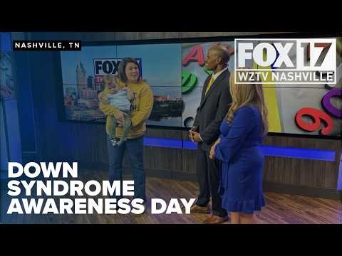 Down syndrome awareness day