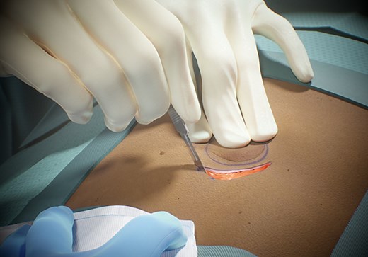 FundamentalVR unveils virtual reality surgery training platform with haptic feedback