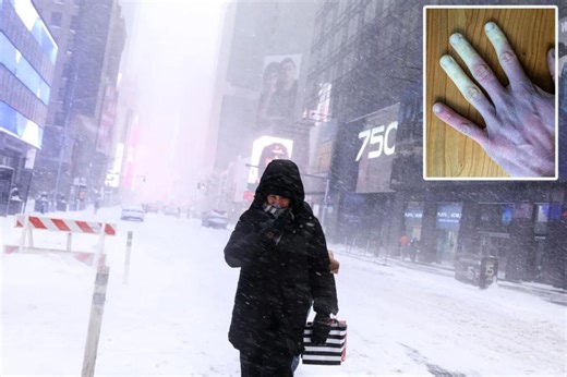 The 4 degrees of frostbite — and what to do to avoid a trip to the hospital