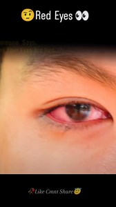 15K views · 262 reactions | Red Eyes  | ALL GAMER | Facebook