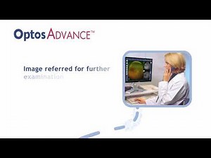 Optos Laser Scanning Technology