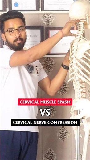 Cervical muscle spasm vs nerve compression #cervicalpain