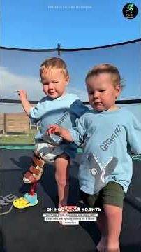 Born Different, But Not Defeated 💪 A Brave Little Boy Walking with Prosthetic Leg 👣 #Inspiration