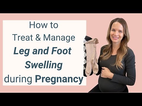 How to Reduce Leg and Foot Swelling during Pregnancy