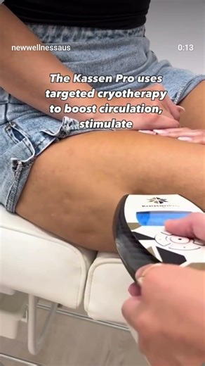 localised Cryotherapy helping cellulite by improving skin and destroying fat in just a few sessions.