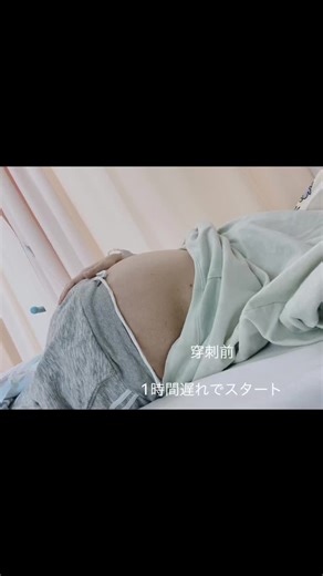 今回も10リットルもの腹水抜き…3日間ほどご飯が食べれなくてキツかったー！！1時間遅れで穿刺スタートでも時間がーー！！1時間後には昼ごはん でも穿刺中！！ご飯より穿刺！！お昼ご飯はスキップして夜まで我慢 我慢した分夜ごはんは完食！！😊✌️#肝硬変 #腹水 #CART #難治性腹水