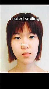 My crazy braces transformation story as a doc