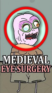 Medieval Eye Surgery Was Terrifying 👁️ 😰 #didyouknow #medieval #history #facts