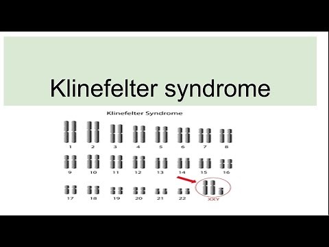 Klinefelter syndrome---Genetics, Characteristics, Diagnosis
