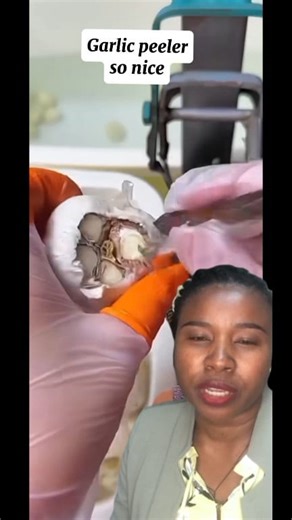 Amazing garlic peeler.. Very nice | Perfect world | Facebook