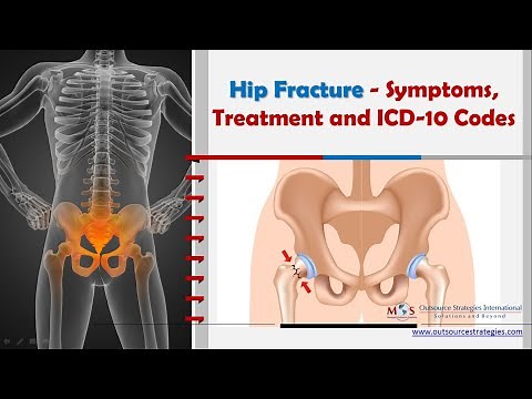 Hip Fracture - Symptoms, Treatment and ICD-10 Codes