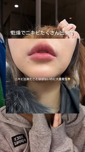 そんあみ | 손아미 | ニキビ肌も落ち着く!寝たまま付けれるパック👀✨ このパックは美容成分エッセンスをそのまま固めて作った ハイドロゲルタイプマスクパックだから エッセンスが流れず顔にぴったり密着して スリーピングパックとして 寝ている間ずっと保湿管理ができるよ🫶✨... | Instagram