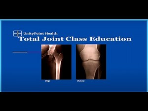 Total Joint Replacement Education - Methodist West Hospital