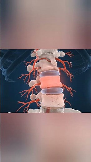 Ankylosing Spondylitis: Why the Spine Becomes Stiff