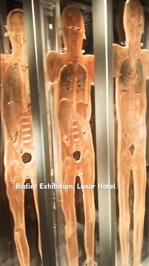 “Unreal! Human Body Sliced & Preserved 🔬 Raw video | Bodies Exhibition at Luxor Las Vegas”