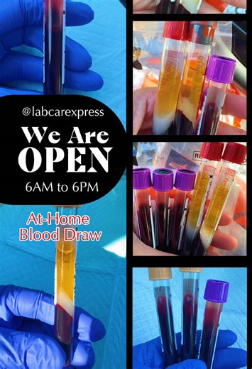 Mobile Phlebotomy Services in Jacksonville Florida! We come to you! #mobilephlebotomy #mobilephlebotomybusiness #mobilephlebotomist #phlebotomist