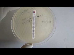 MIC of Vancomycin Determination for Staphylococcus aureus using Epsilometer I E- Test Strip