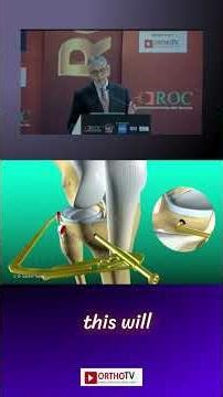 Fibular Collateral Ligament - Dr Sachin Tapasvi