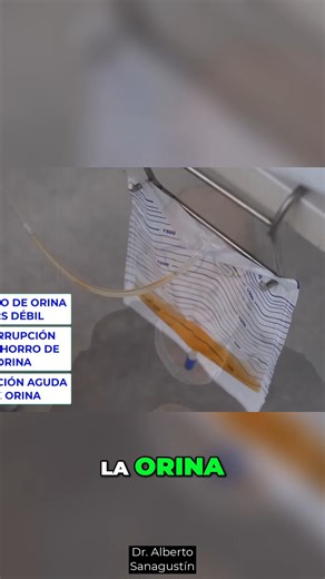 Síntomas de la Prostatitis ¿Cómo Identificarlos Efectivamente Descubre los síntomas de la prostatitis, desde la micción dolorosa hasta el malestar en el abdomen. Conoce las distintas formas de esta enfermedad y cuándo es necesario buscar atención médica. ¡La salud Prostática es fundamental! #Prostatitis #SaludProstática #SíntomasSalud #CuidadoUrológico #Bienestar #SaludMasculina #ConsejosDeSalud #Micción #DolorUrinario #SaludIntegral | Dr. Alberto Sanagustín