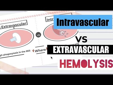 RBC Aging and Death: Intravascular vs Extravascular Hemolysis