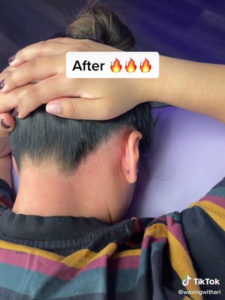 Hairline Wax Before and After Transformation