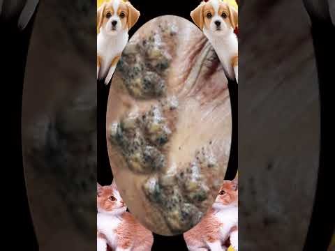 Blackheads Removal #547 | Acne Treatment and Very Satisfying Satisfying Pimple pop #blackheads