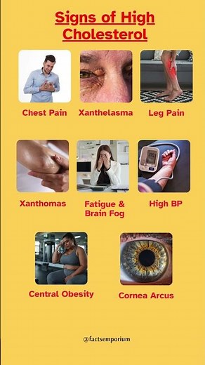 Signs of High Cholesterol You Should Never Ignore | Early Warning Symptoms Explained #healthylife