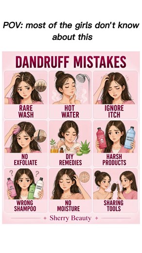 Dandruff Mistakes You Must Stop | Sherry Beauty #tips #haircare #dandruff #shorts