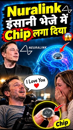😱 Neuralink ने इंसानी दिमाग में लगा दी Chip! फिर हुआ कुछ ऐसा ❤️ #Neuralink #quickfacts #ytshorts