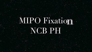 MIPO Proximal Humeral Fracture surgical technique NCB PH locking plate