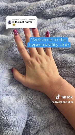 Understanding Hypermobility and Subluxations in Tendons