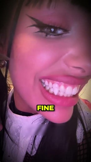 She Couldn’t Take Off Her Vampire Teeth...