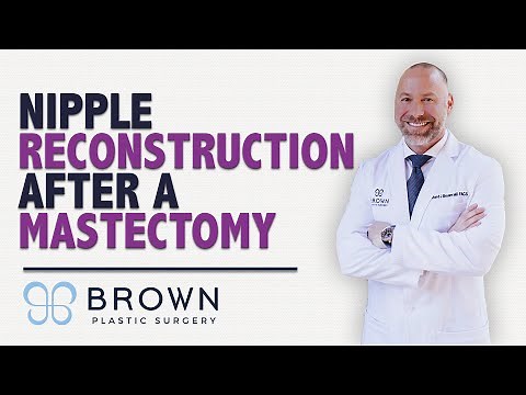Nipple Reconstruction After A Mastectomy | Brown Plastic Surgery