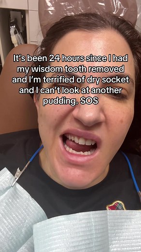 Understanding Dry Socket After Wisdom Tooth Removal