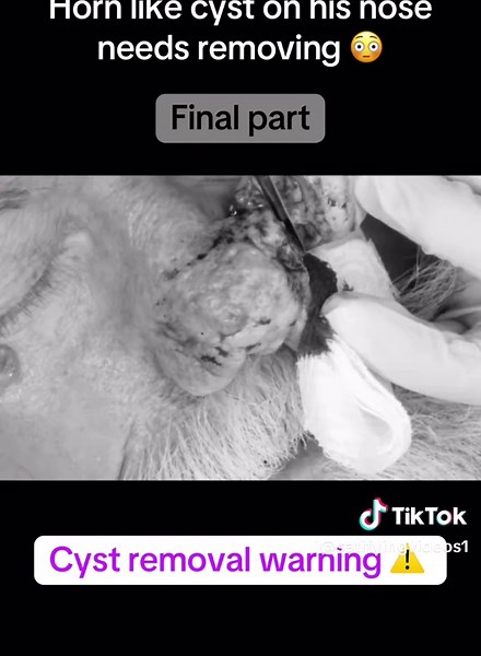 Horn like cyst on his nose needs removing 😳 #satusfyingvideos #skincareroutine #acnetreatment #blackheadsremoval #drpimplepopper #cystpopping #usa_tiktok
