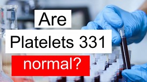 Is Platelet count 331 normal, high or low? What does Platelet count level 331 mean?