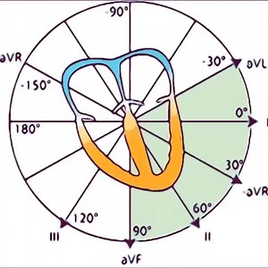 5.6K views · 65 reactions | EKG basics - What is sinus rhythm? | Cardiophilia | Facebook