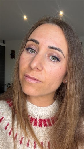 Madlyn Nunès ✨ on Instagram: "J’ai 35 ans et j’ai décidé de faire une blepharoplastie (chirurgie des paupières) Je vous partage mon avant/après/pendant. C’est assez impressionnant mais ça se remet super vite et c’est totalement indolore. À J+15 il ne me reste que quelques bleus et la cicatrice est casi invisible (dans le pli). Comme vous pouvez le constater cette opération n’a pas changé mon visage, juste gommée un léger complexe que j’avais depuis des années. Car oui il n’y a pas d’âge pour avo