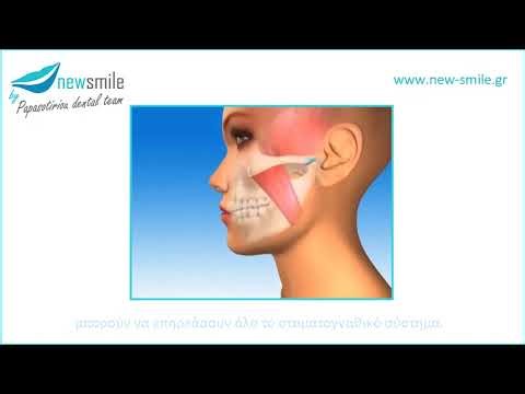 Σύνδρομο Κροταφογναθικής