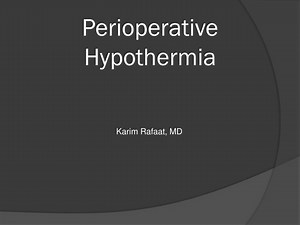 Perioperative Hypothermia - SlideServe