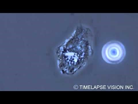 Bacterial phagocytosis by neutrophils