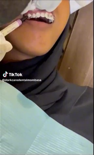 Dorkcare Dental Services (@dorkcaredentalhospital)’s videos with original sound - Dorkcare Dental Services