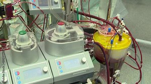Vidéo Stock Operation on a stopped heart with a cardiopulmonary bypass machine.