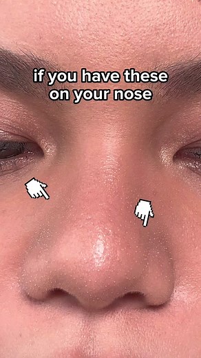 Effective Tips for Sebaceous Filaments and Pore Care with Benefit Cosmetics