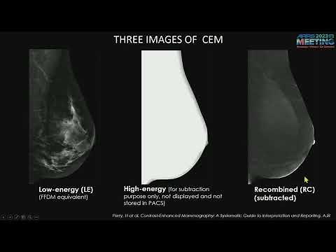 Contrast Enhanced Mammography - Course Sample