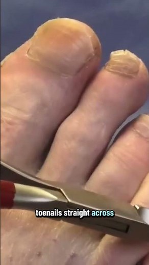 They say to cut toenails straight across, but I trim the edges