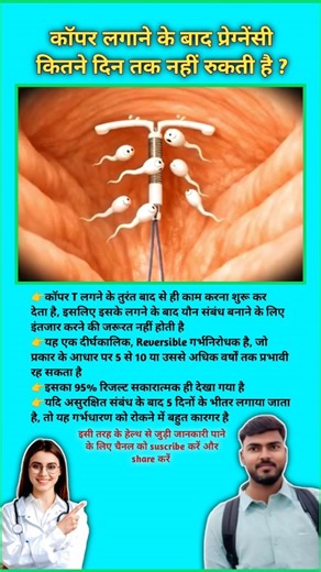 How many days does pregnancy last after inserting a Copper T? Function of Copper Tube || #viral