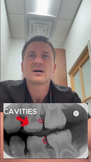 Before and After a Laser Filling